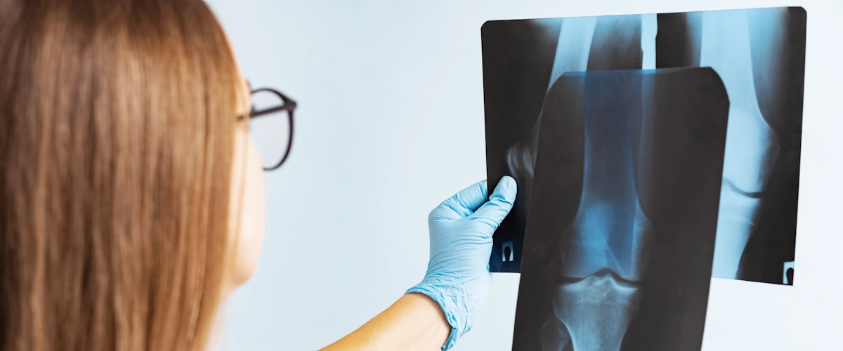 Tecnico che esegue una radiografia domiciliare su un paziente