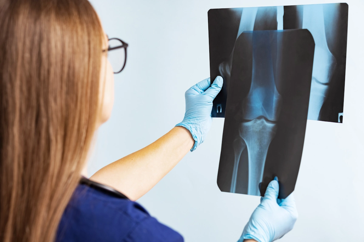 Radiografia Domiciliare: Esami Radiologici a Casa del Paziente